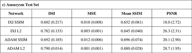 Figure 4 for Variational Autoencoders with a Structural Similarity Loss in Time of Flight MRAs