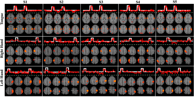 Figure 3 for Disentangling Spatial-Temporal Functional Brain Networks via Twin-Transformers
