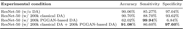 Figure 2 for Infinite Brain MR Images: PGGAN-based Data Augmentation for Tumor Detection