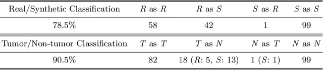 Figure 4 for Infinite Brain MR Images: PGGAN-based Data Augmentation for Tumor Detection