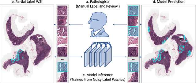 Figure 1 for Self-similarity Student for Partial Label Histopathology Image Segmentation