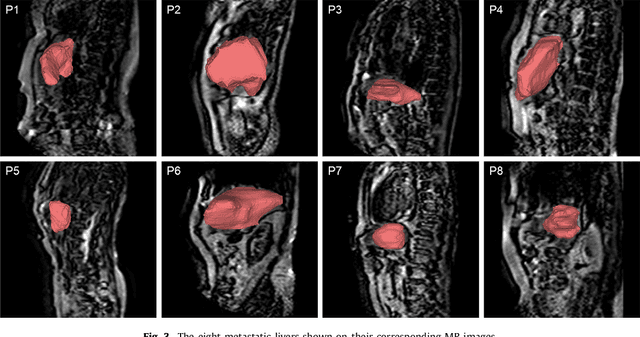 Figure 3 for A Real-time and Registration-free Framework for Dynamic Shape Instantiation