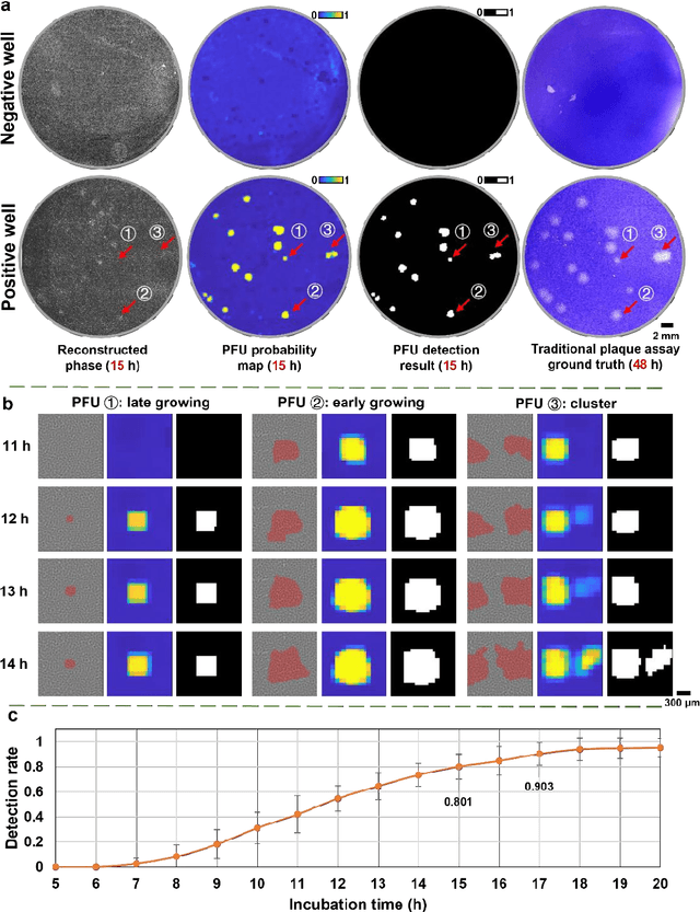 Figure 3 for Stain-free, rapid, and quantitative viral plaque assay using deep learning and holography