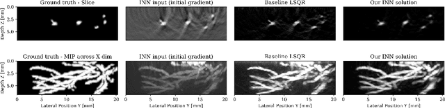 Figure 1 for Memory Efficient Invertible Neural Networks for 3D Photoacoustic Imaging