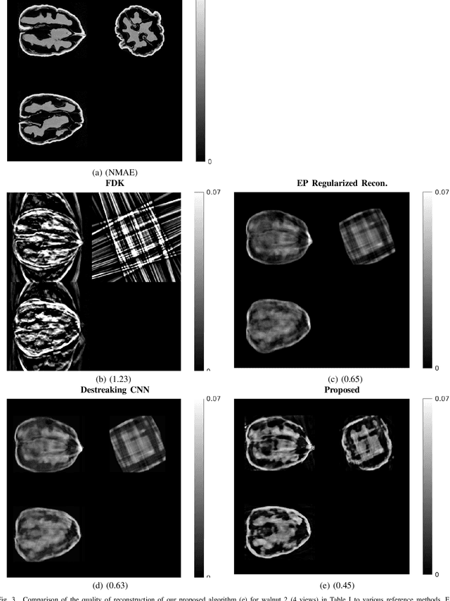 Figure 3 for Sparse-view Cone Beam CT Reconstruction using Data-consistent Supervised and Adversarial Learning from Scarce Training Data