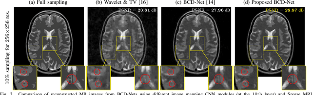 Figure 3 for Deep BCD-Net Using Identical Encoding-Decoding CNN Structures for Iterative Image Recovery
