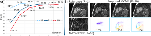 Figure 3 for Learning-based and unrolled motion-compensated reconstruction for cardiac MR CINE imaging