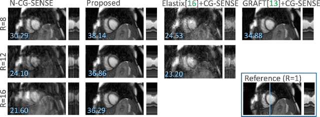 Figure 4 for Learning-based and unrolled motion-compensated reconstruction for cardiac MR CINE imaging
