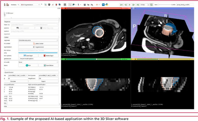 Figure 1 for Automatic Quantification of Volumes and Biventricular Function in Cardiac Resonance. Validation of a New Artificial Intelligence Approach