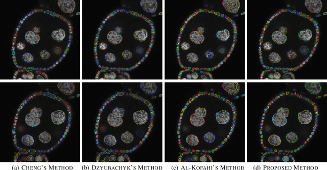 Figure 2 for Robust Segmentation of Cell Nuclei in 3-D Microscopy Images