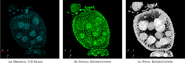 Figure 3 for Robust Segmentation of Cell Nuclei in 3-D Microscopy Images