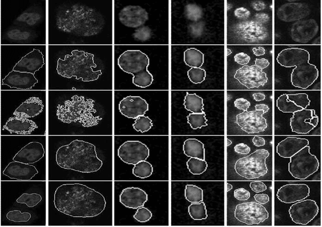 Figure 4 for Robust Segmentation of Cell Nuclei in 3-D Microscopy Images