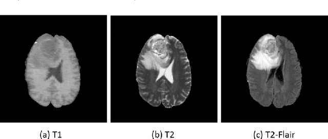 Figure 1 for MRI Cross-Modality NeuroImage-to-NeuroImage Translation