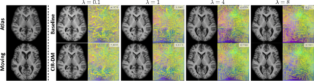 Figure 3 for Conditional Deformable Image Registration with Convolutional Neural Network