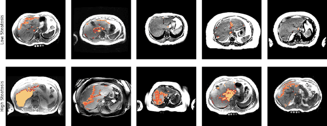 Figure 2 for Unsupervised deep clustering for predictive texture pattern discovery in medical images