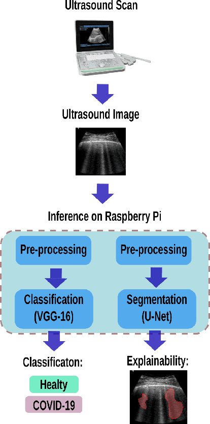 Figure 1 for Implementing a Detection System for COVID-19 based on Lung Ultrasound Imaging and Deep Learning