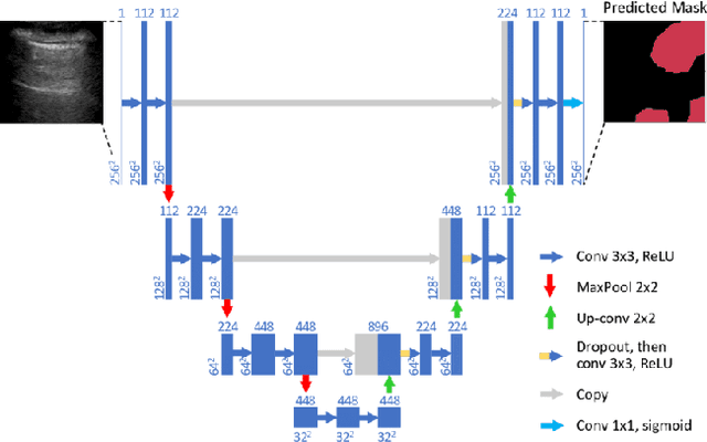 Figure 3 for Implementing a Detection System for COVID-19 based on Lung Ultrasound Imaging and Deep Learning