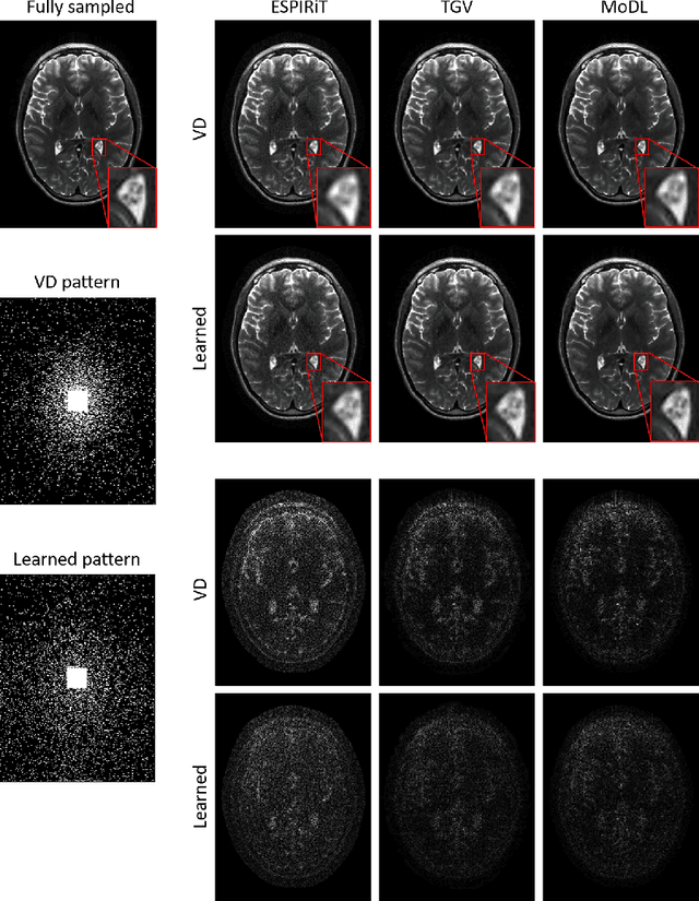 Figure 4 for Extending LOUPE for K-space Under-sampling Pattern Optimization in Multi-coil MRI