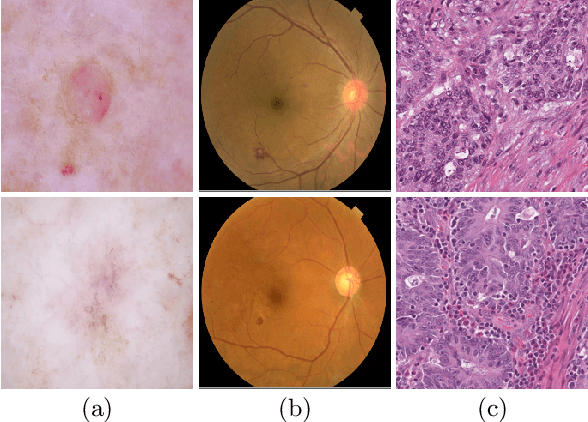 Figure 1 for Distractor-Aware Neuron Intrinsic Learning for Generic 2D Medical Image Classifications