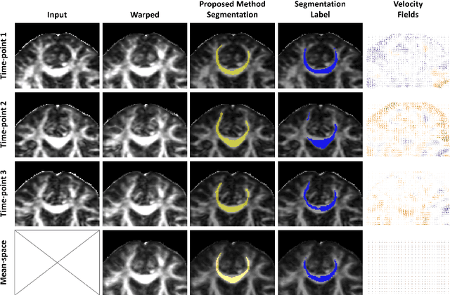 Figure 3 for Learning unbiased registration and joint segmentation: evaluation on longitudinal diffusion MRI