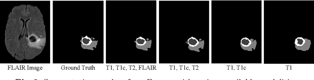 Figure 3 for mmFormer: Multimodal Medical Transformer for Incomplete Multimodal Learning of Brain Tumor Segmentation