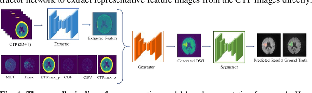 Figure 1 for Generative Model-Based Ischemic Stroke Lesion Segmentation