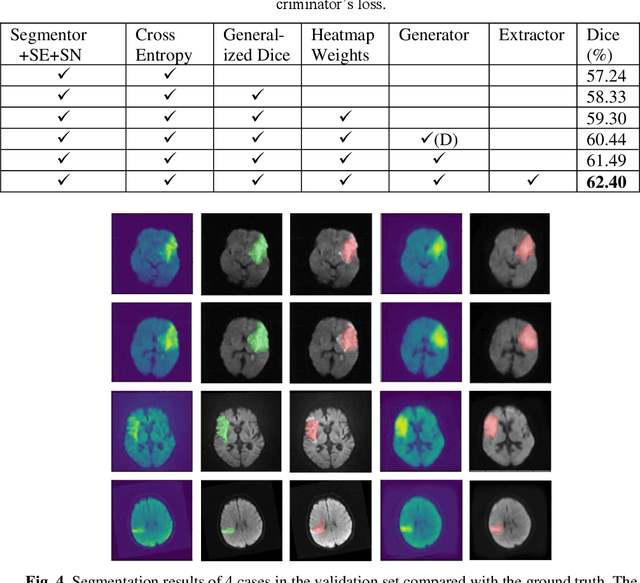 Figure 2 for Generative Model-Based Ischemic Stroke Lesion Segmentation