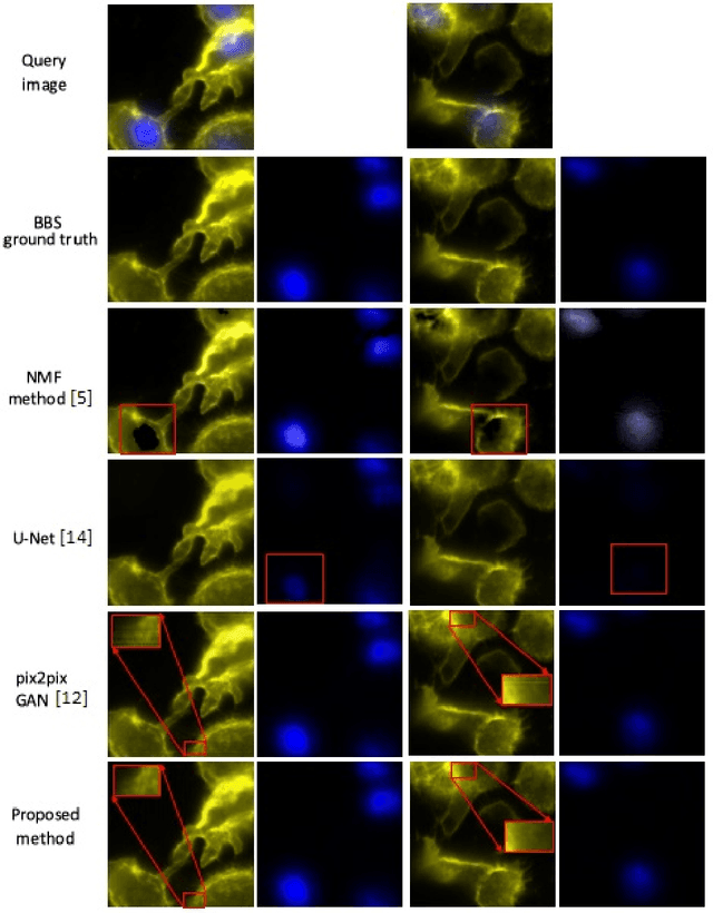 Figure 3 for Blind stain separation using model-aware generative learning and its applications on fluorescence microscopy images