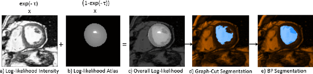 Figure 3 for Integrating Atlas and Graph Cut Methods for LV Segmentation from Cardiac Cine MRI
