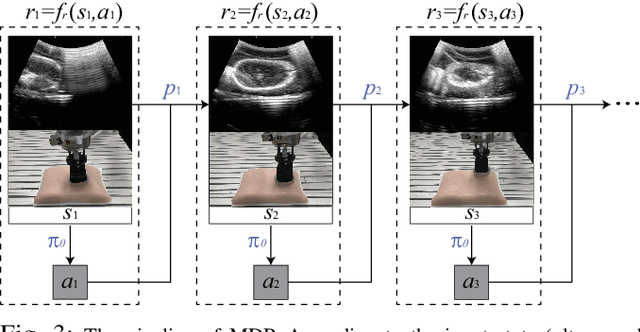 Figure 3 for Learning Robotic Ultrasound Scanning Skills via Human Demonstrations and Guided Explorations