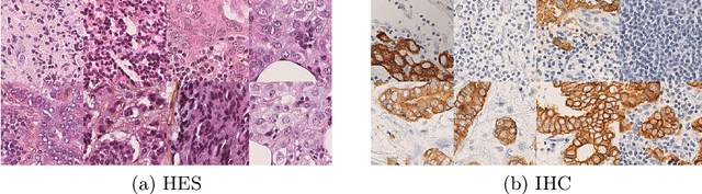 Figure 1 for Region-guided CycleGANs for Stain Transfer in Whole Slide Images