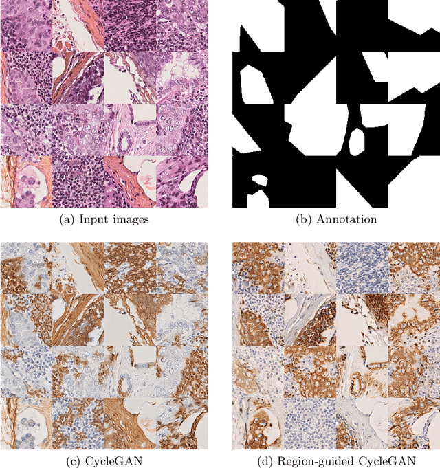 Figure 4 for Region-guided CycleGANs for Stain Transfer in Whole Slide Images