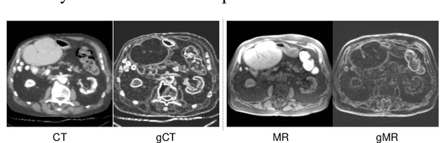 Figure 1 for Unsupervised Multimodal Image Registration with Adaptative Gradient Guidance