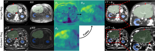 Figure 4 for Unsupervised Multimodal Image Registration with Adaptative Gradient Guidance