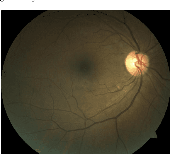 Figure 4 for A Session Based Blind Watermarking Technique within the NROI of Retinal Fundus Images for Authentication Using DWT, Spread Spectrum and Harris Corner Detection