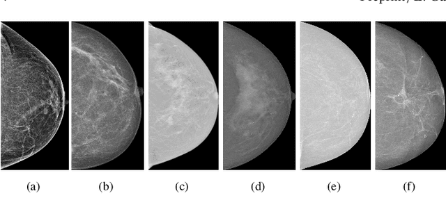 Figure 3 for Domain generalization in deep learning-based mass detection in mammography: A large-scale multi-center study