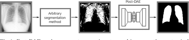 Figure 1 for Anatomical Priors for Image Segmentation via Post-Processing with Denoising Autoencoders