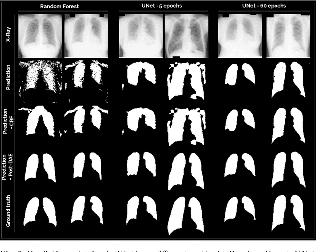 Figure 3 for Anatomical Priors for Image Segmentation via Post-Processing with Denoising Autoencoders