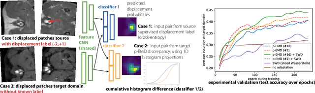 Figure 1 for Unsupervised learning of multimodal image registration using domain adaptation with projected Earth Move's discrepancies