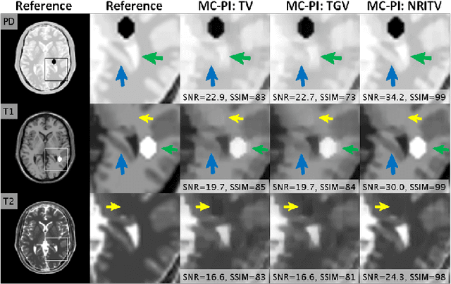 Figure 3 for A multi-channel framework for joint reconstruction of multi-contrast parallel MRI
