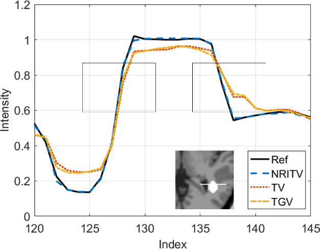 Figure 4 for A multi-channel framework for joint reconstruction of multi-contrast parallel MRI