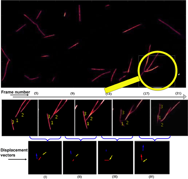 Figure 1 for Instance-Level Microtubule Segmentation Using Recurrent Attention