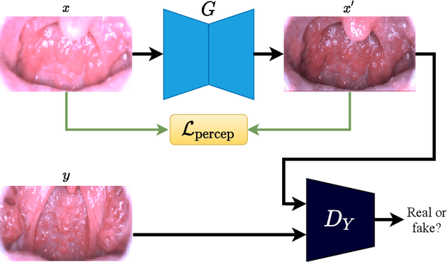 Figure 4 for MIINet: An Image Quality Improvement Framework for Supporting Medical Diagnosis