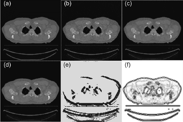 Figure 4 for Intelligent Parameter Tuning in Optimization-based Iterative CT Reconstruction via Deep Reinforcement Learning