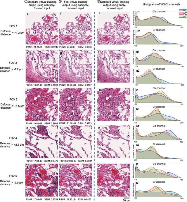 Figure 3 for Virtual staining of defocused autofluorescence images of unlabeled tissue using deep neural networks