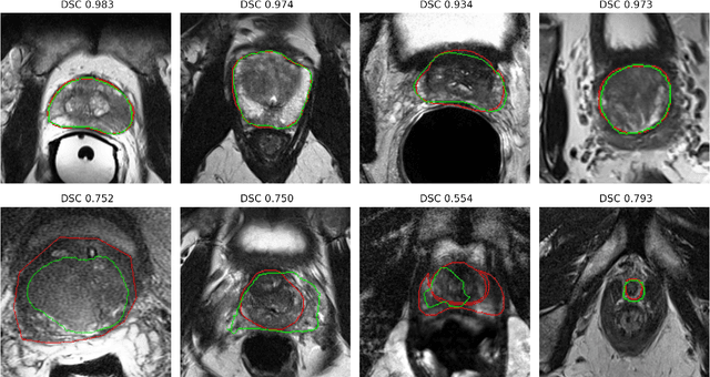 Figure 2 for Deep learning in magnetic resonance prostate segmentation: A review and a new perspective