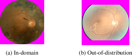Figure 1 for Distributional Shifts in Automated Diabetic Retinopathy Screening