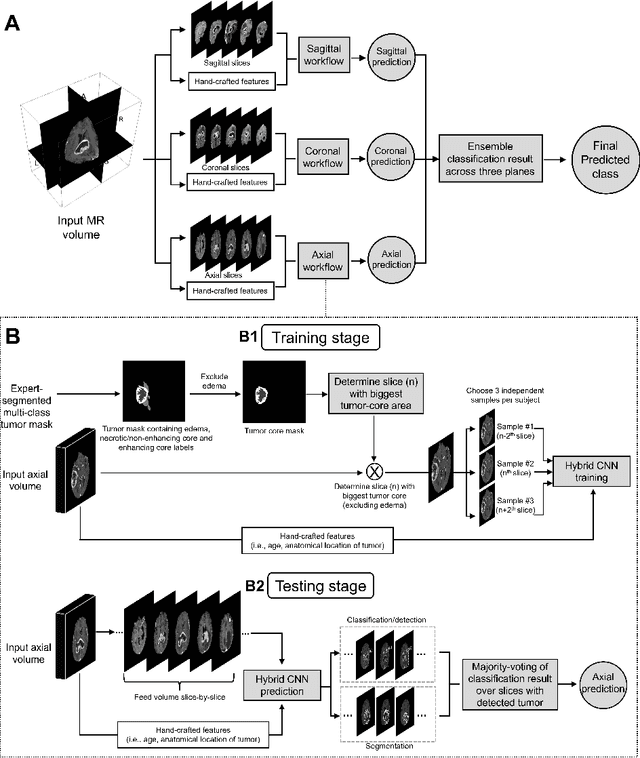 Figure 3 for MRI-based classification of IDH mutation and 1p/19q codeletion status of gliomas using a 2.5D hybrid multi-task convolutional neural network