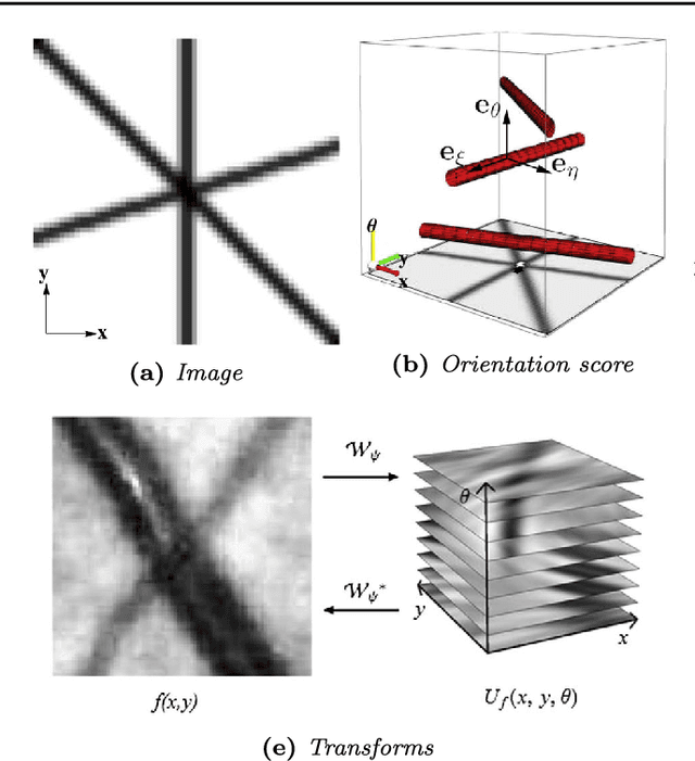 Figure 1 for A Multi-Orientation Analysis Approach to Retinal Vessel Tracking