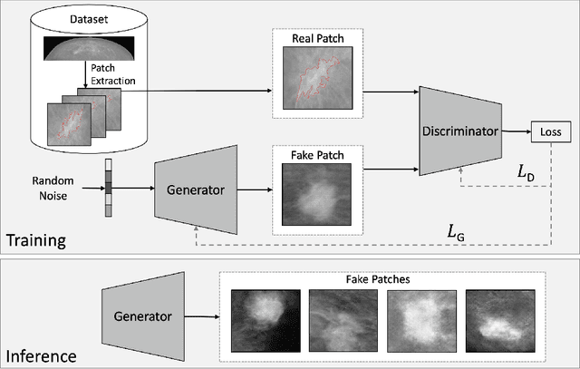 Figure 3 for Sharing Generative Models Instead of Private Data: A Simulation Study on Mammography Patch Classification